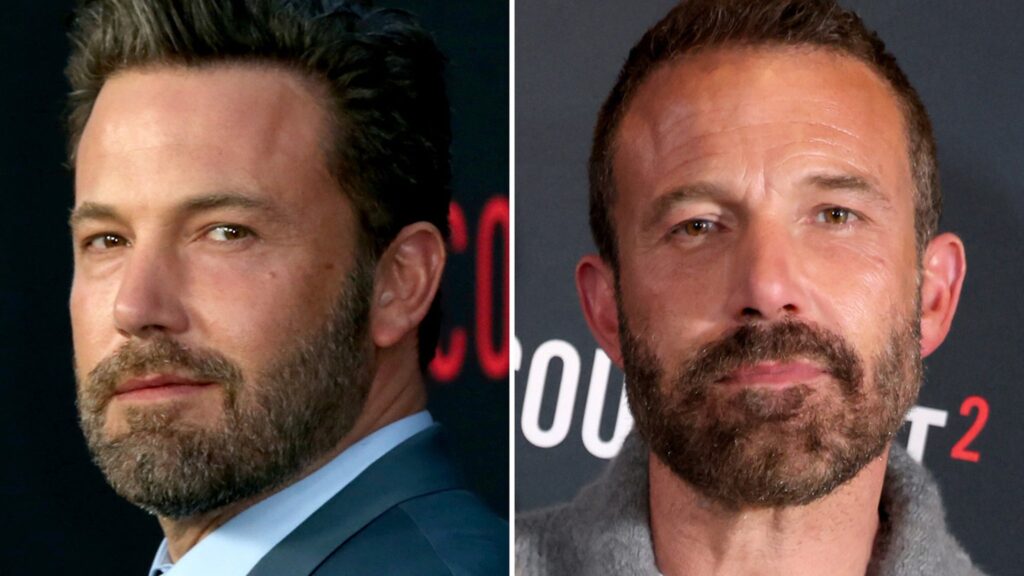 Ben Affleck's Age-Defying Looks: Natural Charm or Cosmetic Enhancement? | Hollywood Star Evolution Ben Affleck -- Good Genes or Good Docs?!