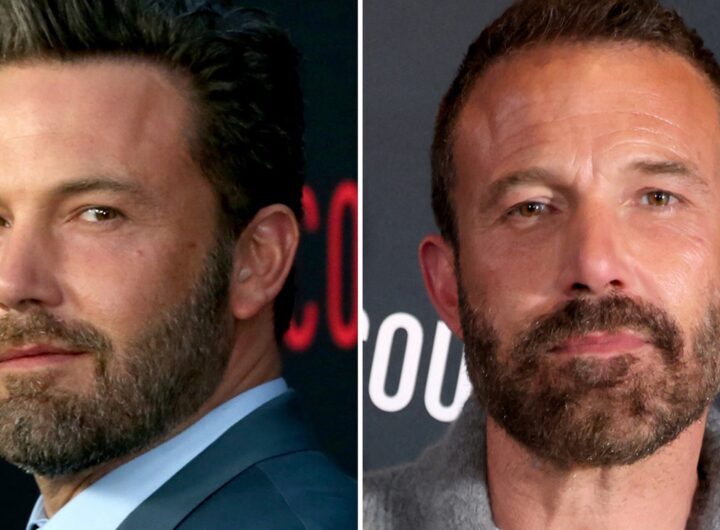 Ben Affleck -- Good Genes or Good Docs?!