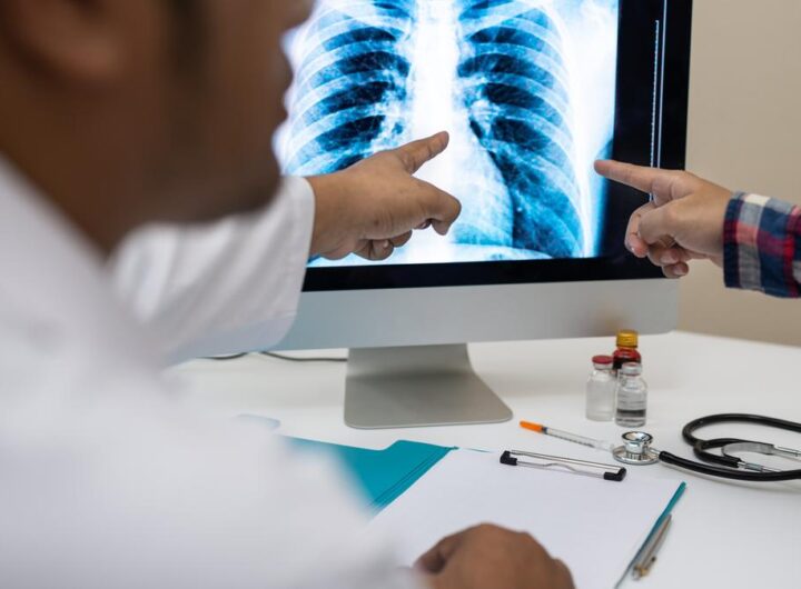 AstraZeneca, Qure.ai complete AI-enabled assessment of 5 million chest X-rays for lung cancer 
